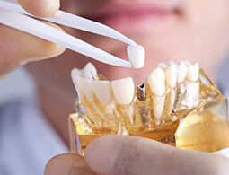 Dr. Grossman restores smiles with dental implants in Concord.
