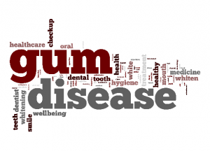 gum disease