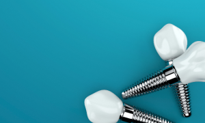 three dental implants